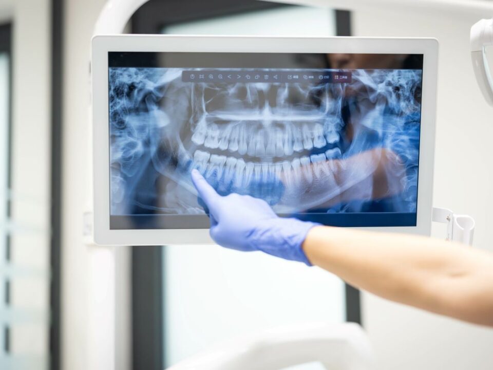 radiographie dentaire